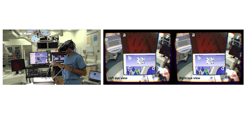 novel-mixed-reality-navigation-laparoscopic-surgery-3